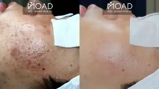 모아드 사진