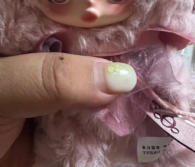 오르트네일 사진 5