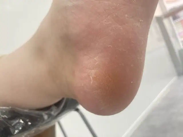 스톤힙 사진 4