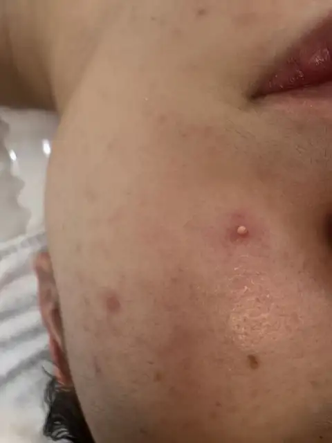 피치피치 사진 8