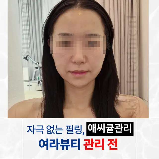 여라뷰티 사진 3