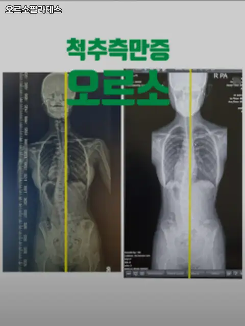 필라테스오르소 사진 7