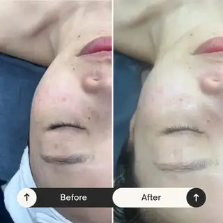 브로우데이 사진