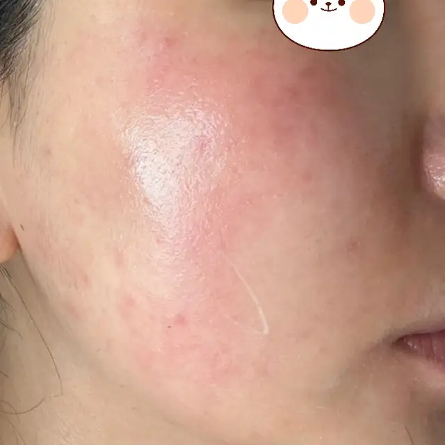 헤라에스테틱 사진 2