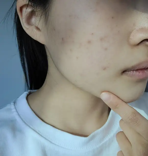비아에스테 사진 3