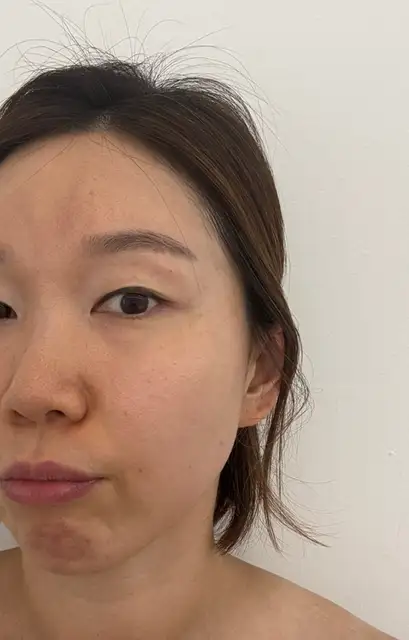 온누아에스테틱 송도점 사진 6