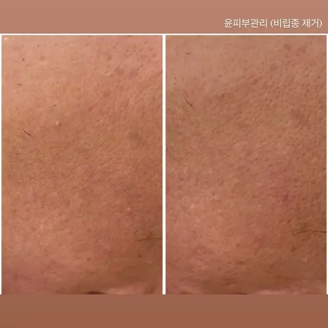 윤피부관리 사진 8
