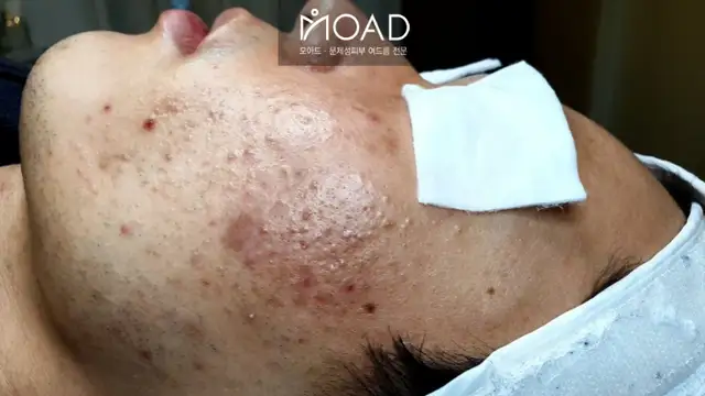 모아드 사진 2