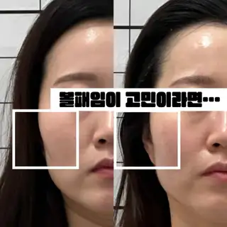 쉼스킨케어 사진