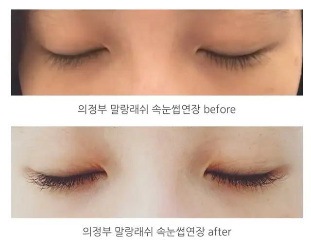 말랑래쉬 사진 8