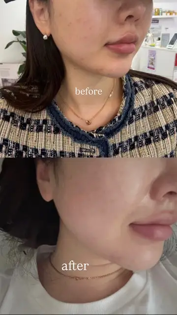 블링미뷰티에스테틱 사진 7