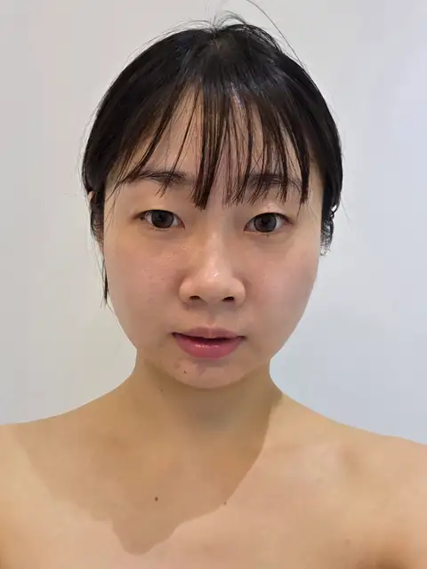 림프핏 에스테틱 사진 2