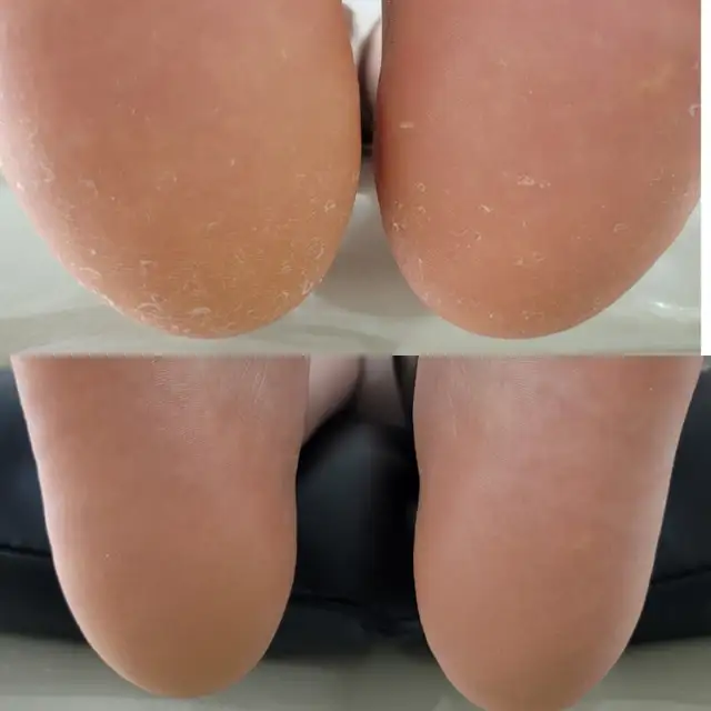 네일봄 사진 5