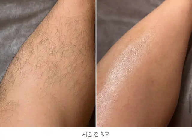왁싱랩 남자왁싱 마곡점 사진 2