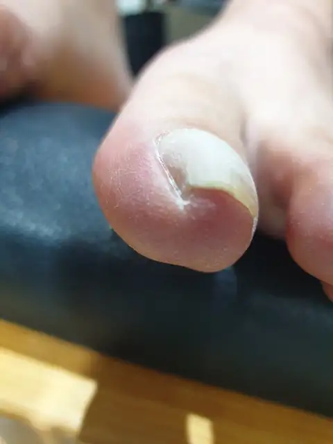 뷰티엔젤 사진 2