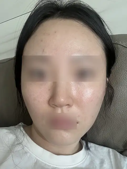 윤스킨 사진 5