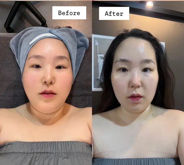 미그리다 사진 2