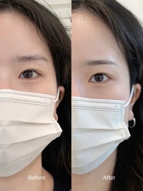 아브힐 사진 7