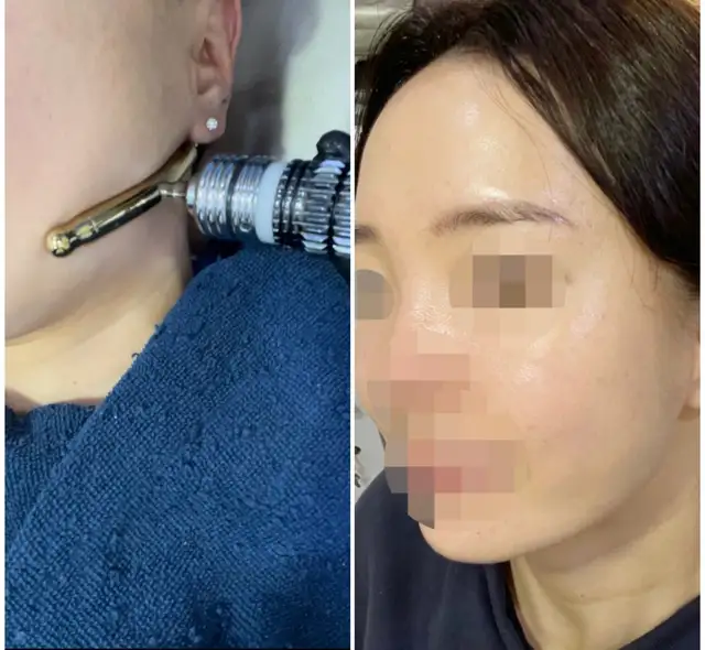 채움피부연구소 사진 7