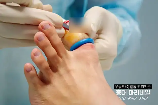 푸스케어 홍대점 마리네일 사진 5