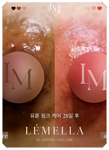카라케어 사진 3