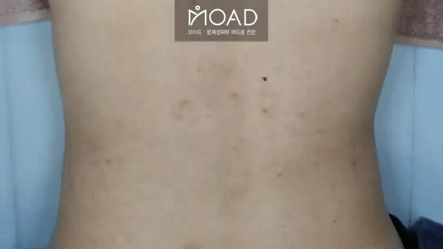 모아드 사진 4