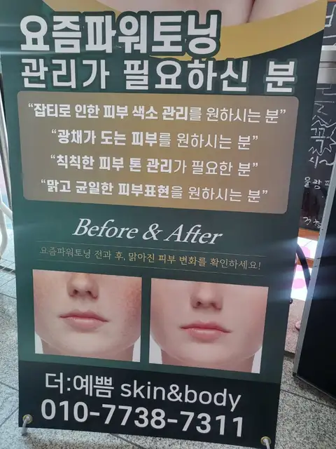 더예쁨스킨앤바디 사진 2