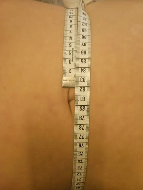 포블랑슈아크네 사진 3