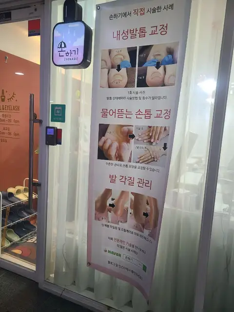 손하기 사진 4