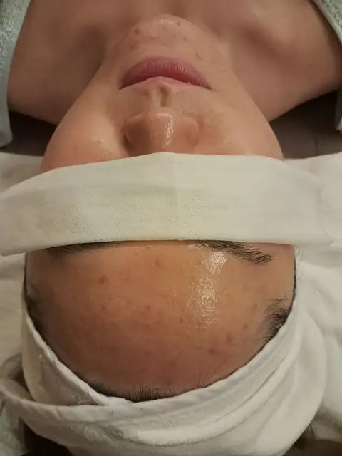 채움 스킨앤바디 사진 4