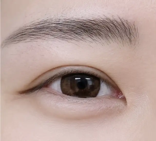 디오뜨네일 사진 4