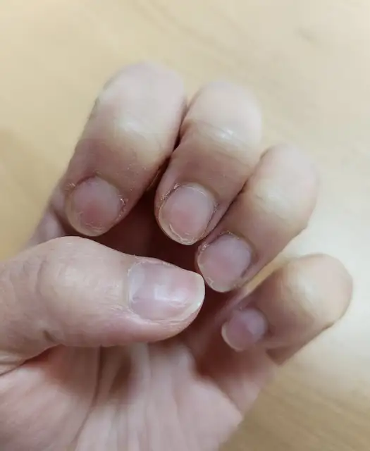 로와네일 사진 2