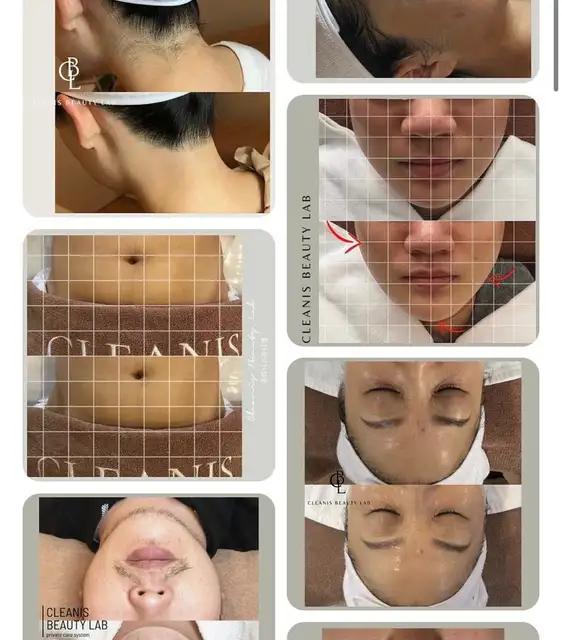 클리니스뷰티랩 사진 5