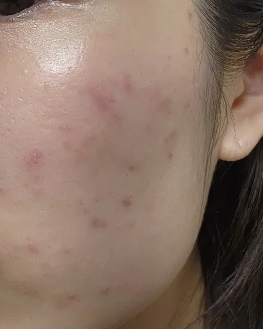 림에스테틱 사진 6