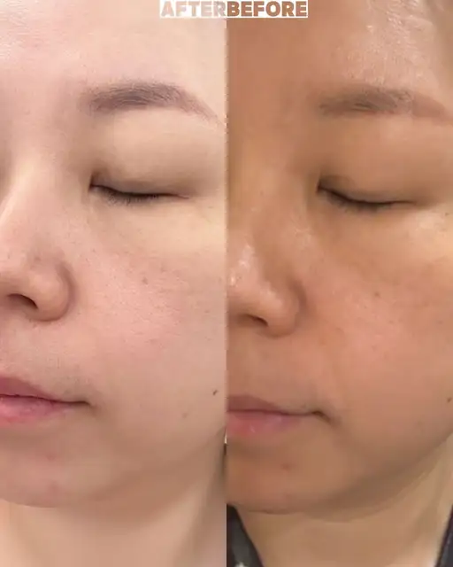 이브뷰티센터 서면점 사진 5