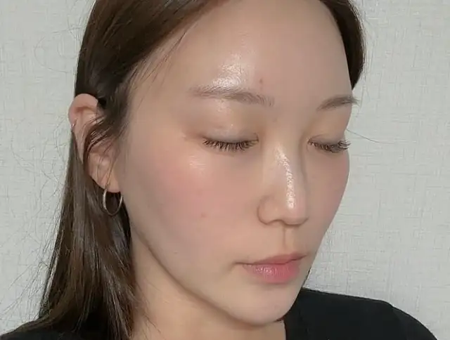 셀린에스테틱 사진 4