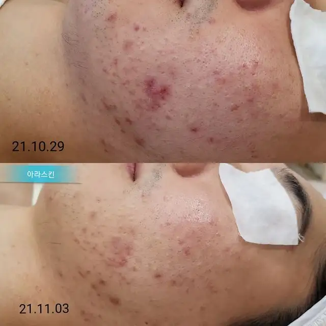 아라스킨케어 사진 5