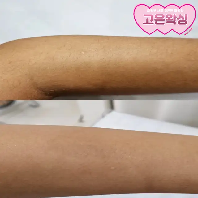 고은왁싱 사진 3