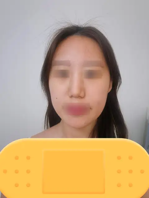 델라에스테틱 사진 3
