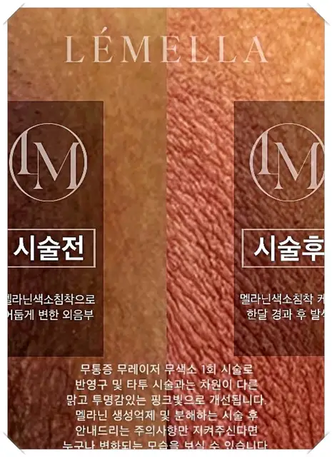카라케어 사진 6
