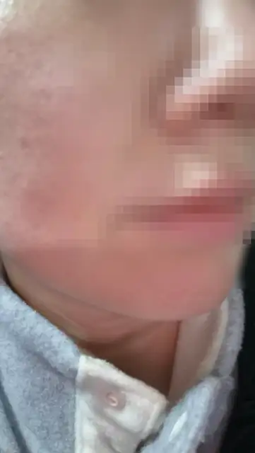 파인더트리에스테틱 사진 4