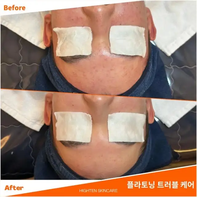 하이텐에스테틱 사진 3