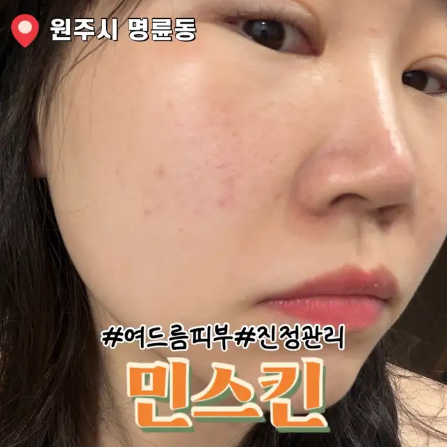 민스킨 사진 7