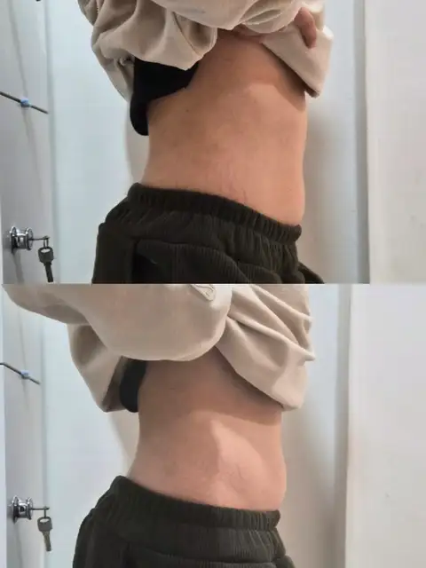 애리서면왁싱 사진 3