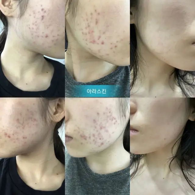 아라스킨케어 사진 7
