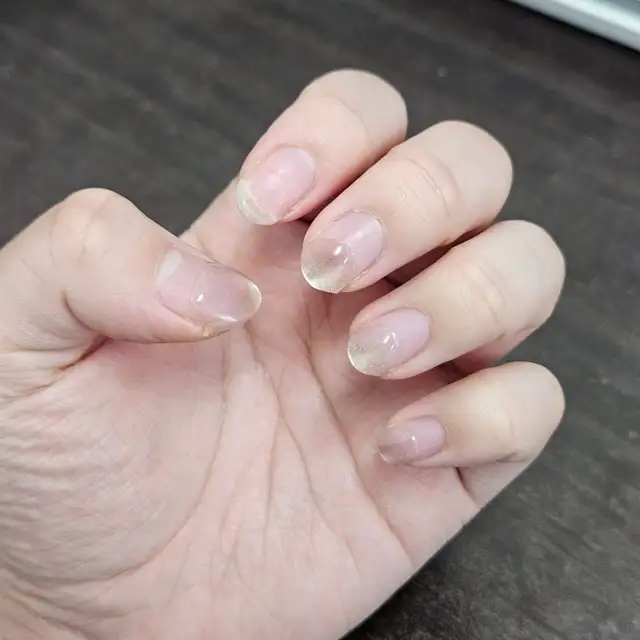 린네일 사진 3