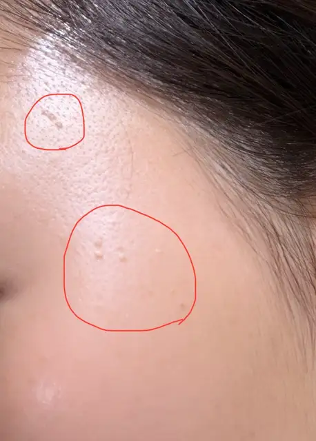 디어브로우 청라눈썹&셀핏바디피부 사진 2