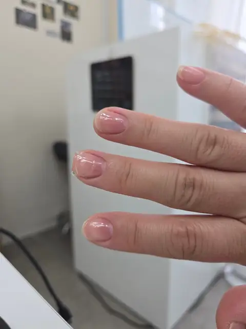 디엑스티네일 사진 6