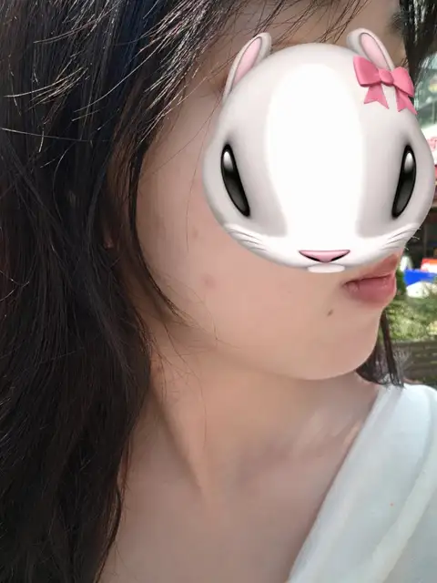 림에스테틱 사진 4