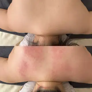 민스킨바디 사진